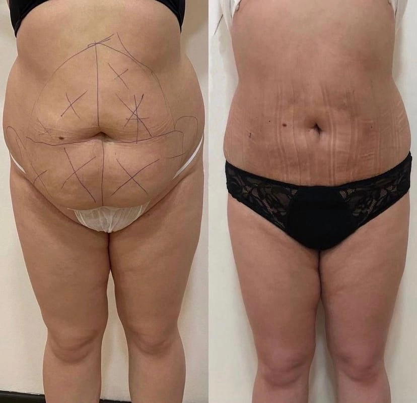 Nemis millatlararo jinsiy aloqa Brunette ajoyib portlash beradi. Onlayn porno tomosha qilish.