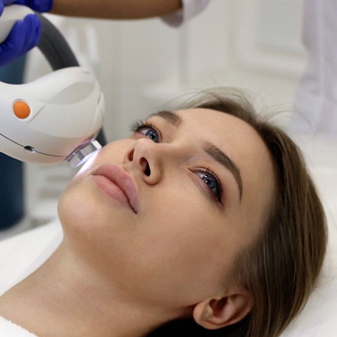 Фотоомоложение на аппарате М22