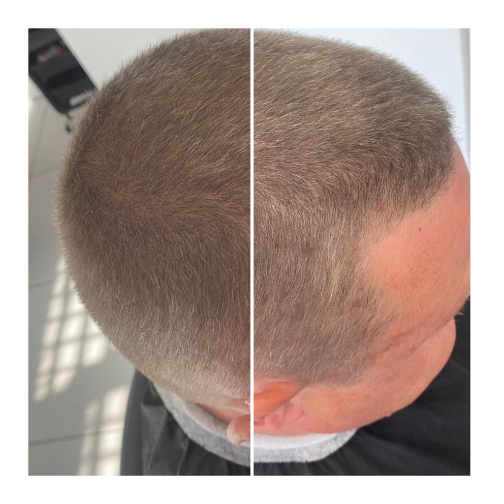 Камуфляж седины