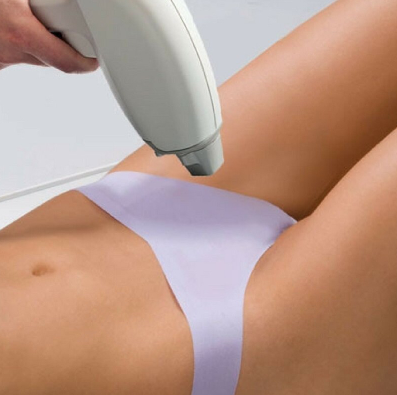 Лазерная Эпиляция Женщины: Классическое бикини (по линии трусиков)