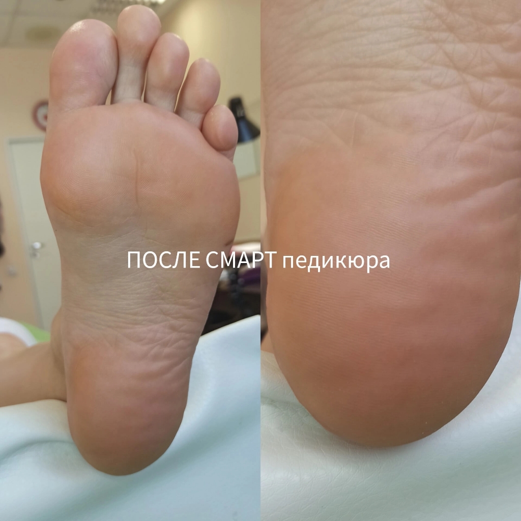 Полный педикюр СМАРТ