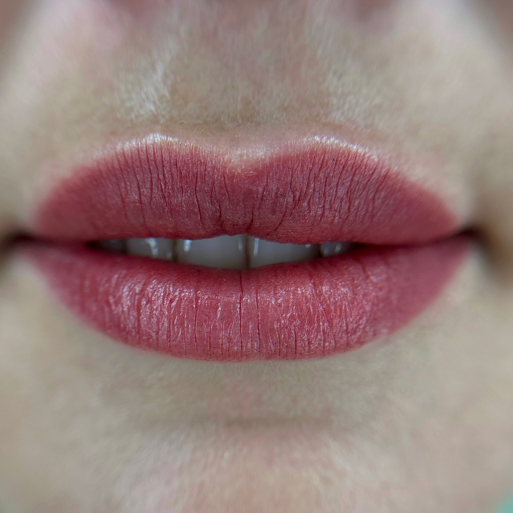 Коррекция (губы)