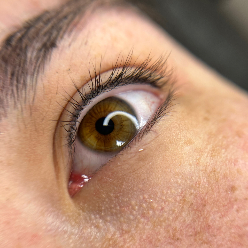 Коррекция (межресничка)