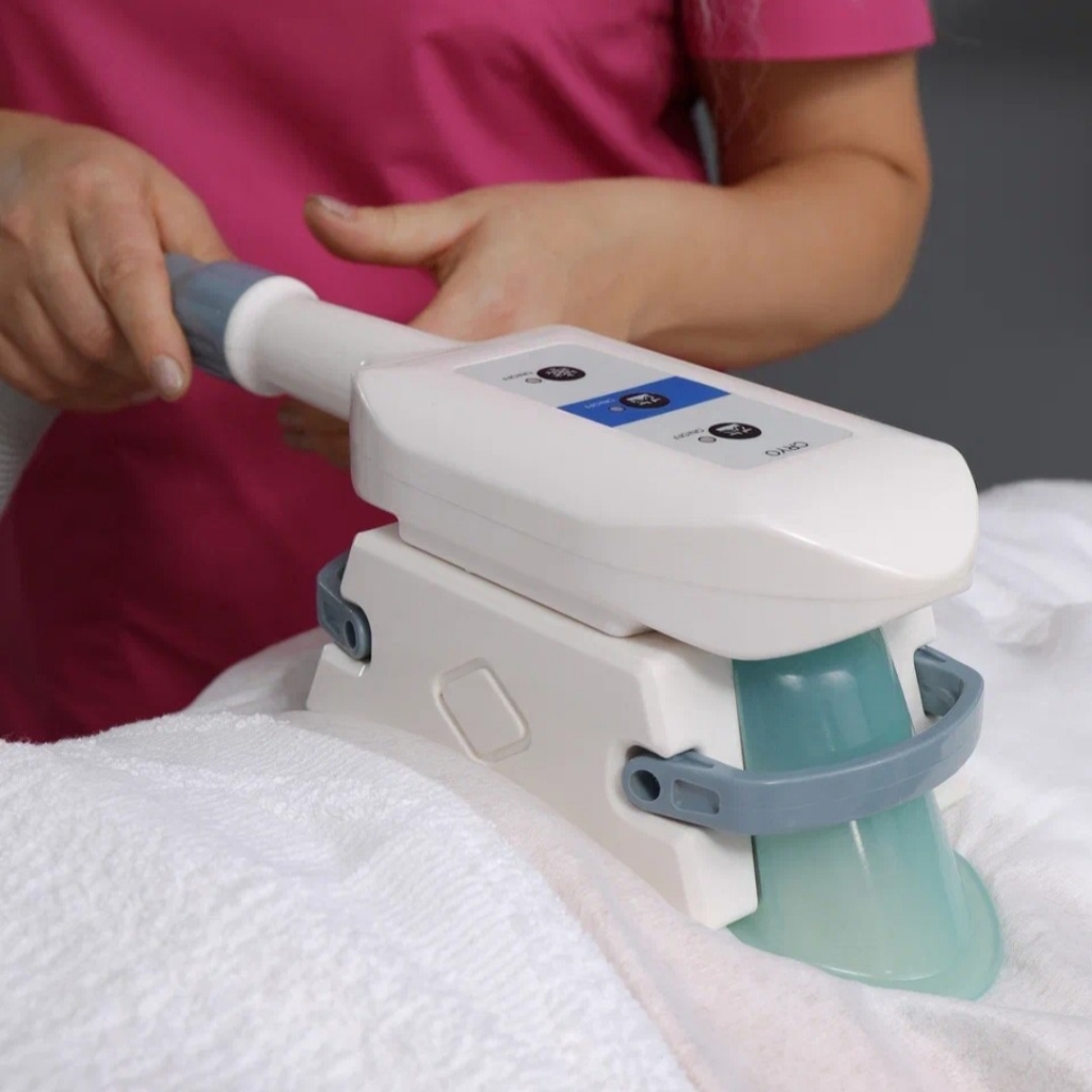 Криолиполиз 1 зона