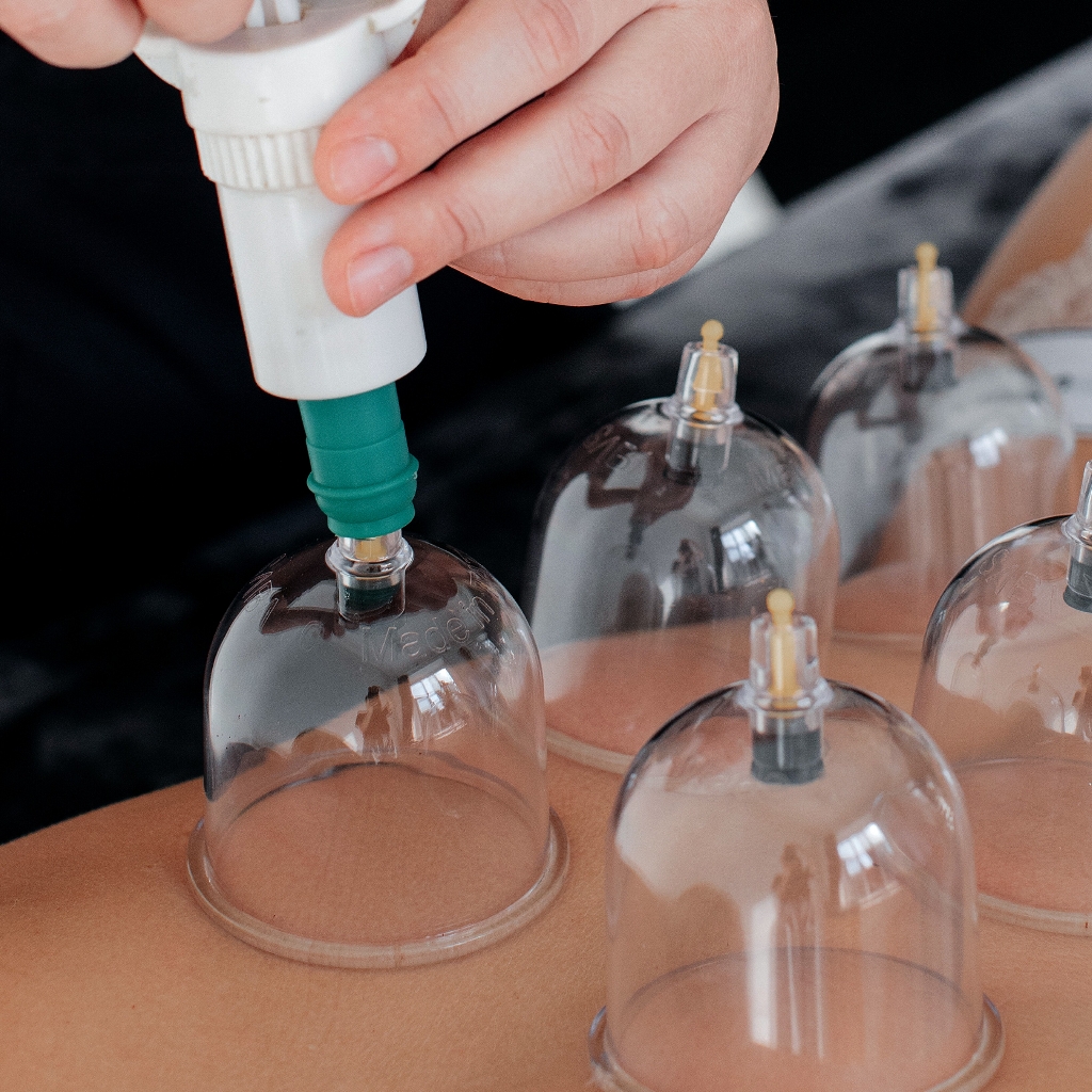 Баночный массаж