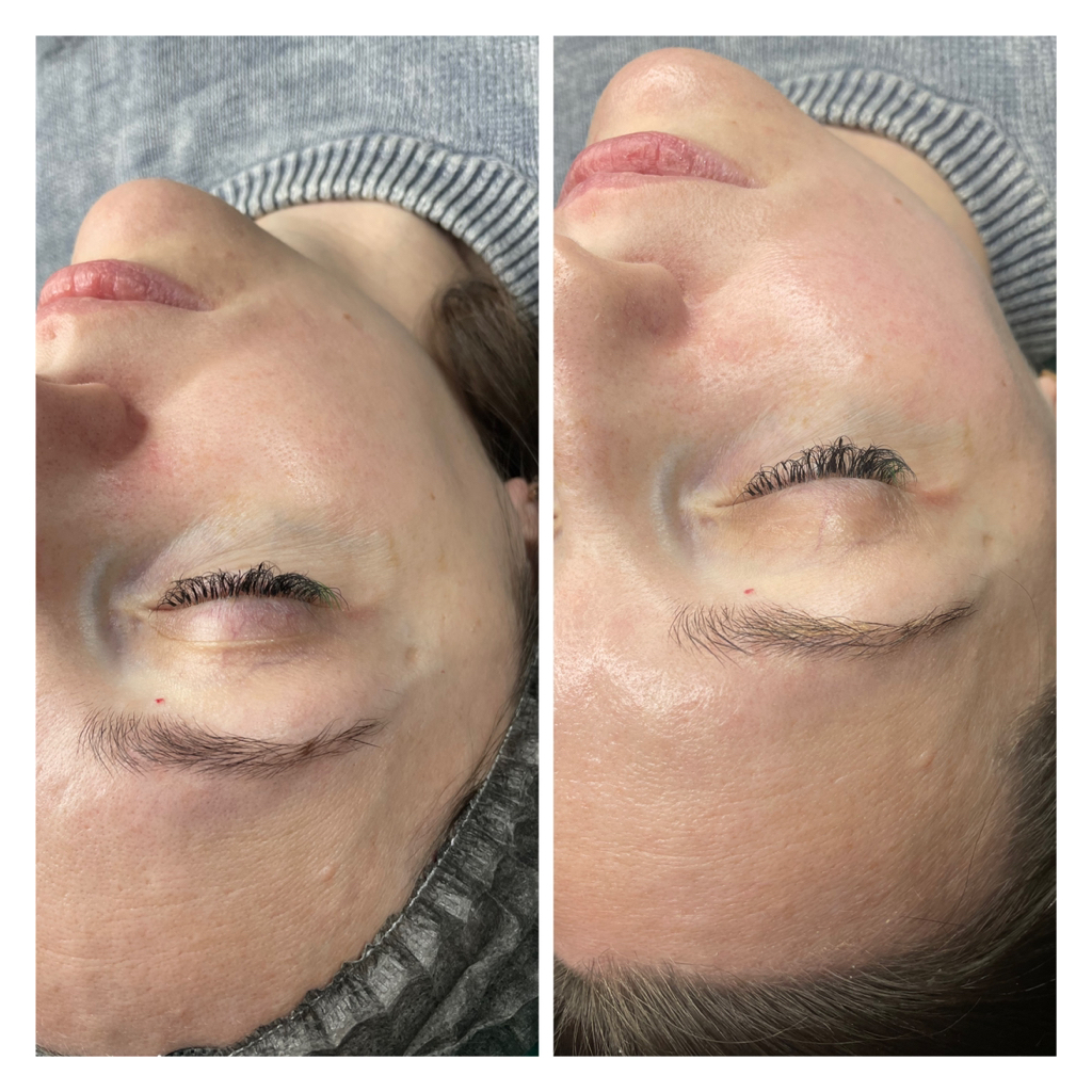 BB Glow (эффект тонального крема)