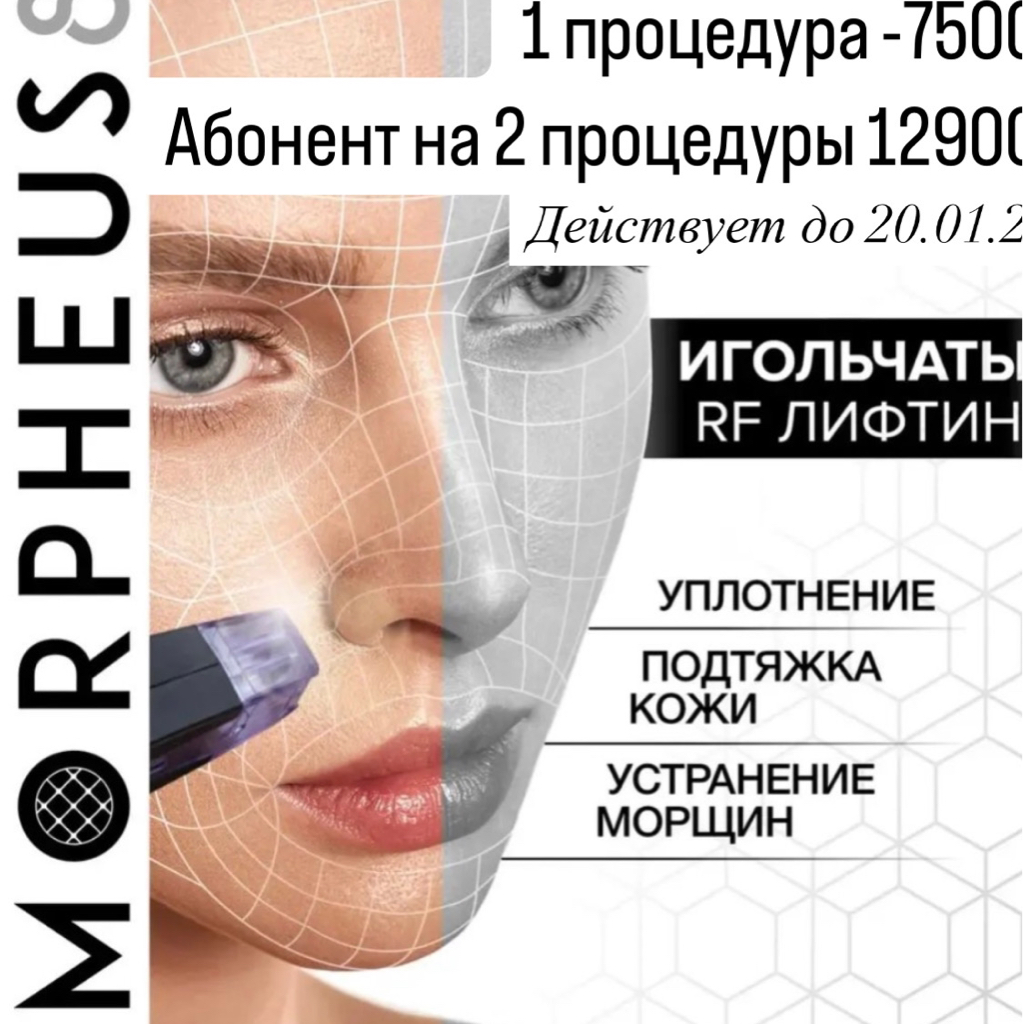Акция Морфиус Rf микроигольчатый  -30%