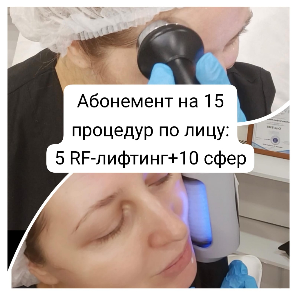 1 из 15 сеансов по лицу RF-лифтинг либо сфера