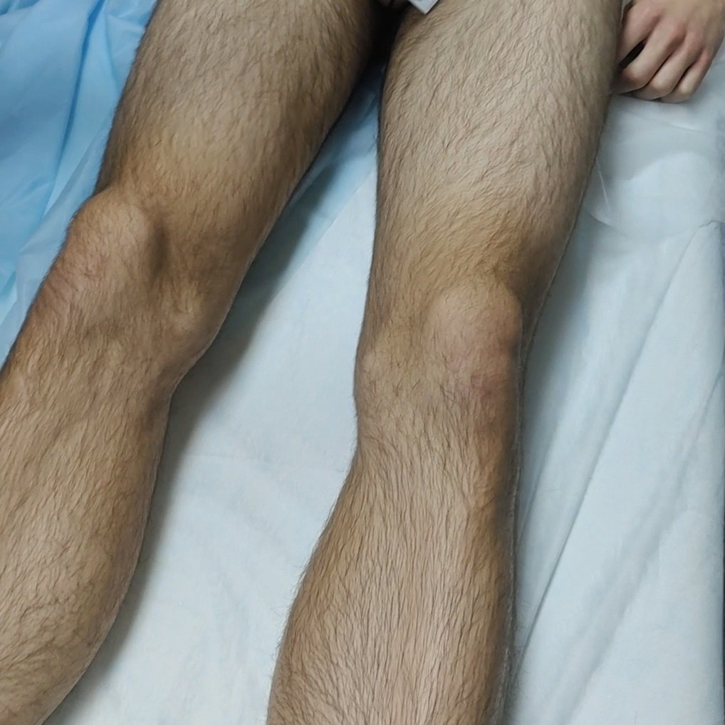 Ноги полностью