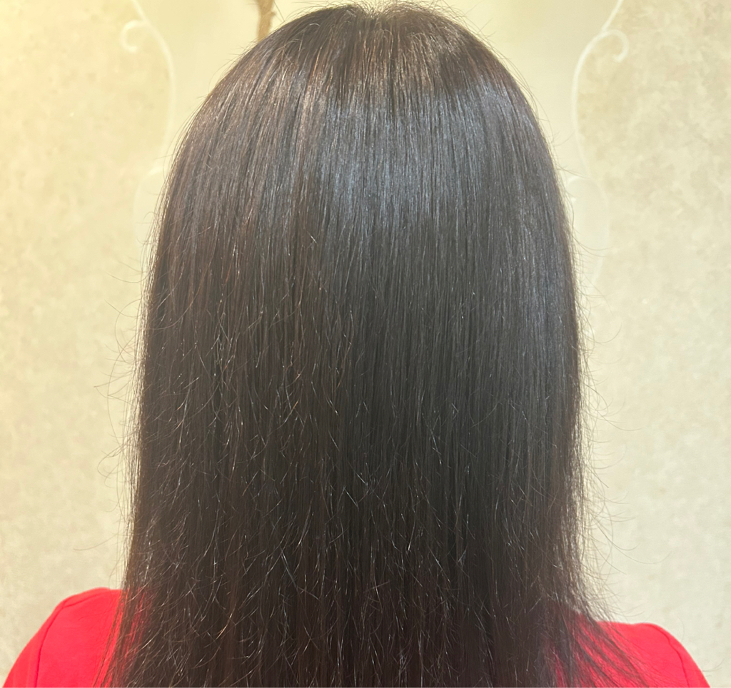 Холодный ботокс от 30-50 см