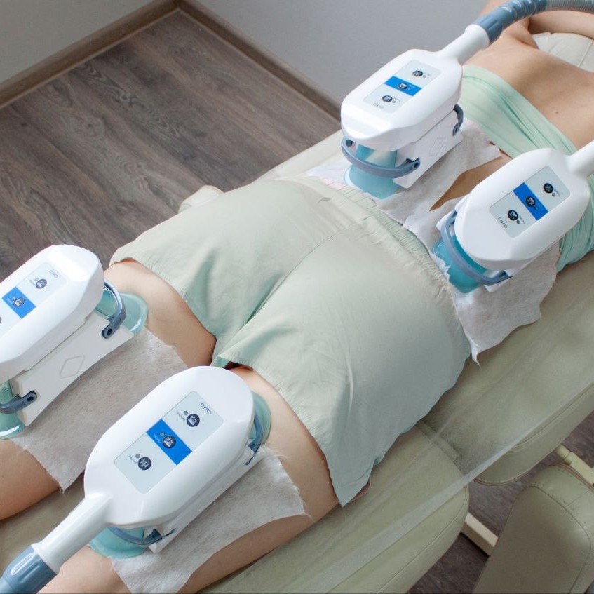 Криолиполиз 4 зоны