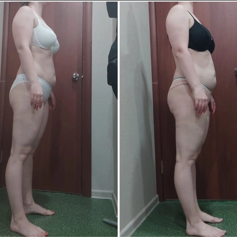 Лимфодренажный массаж