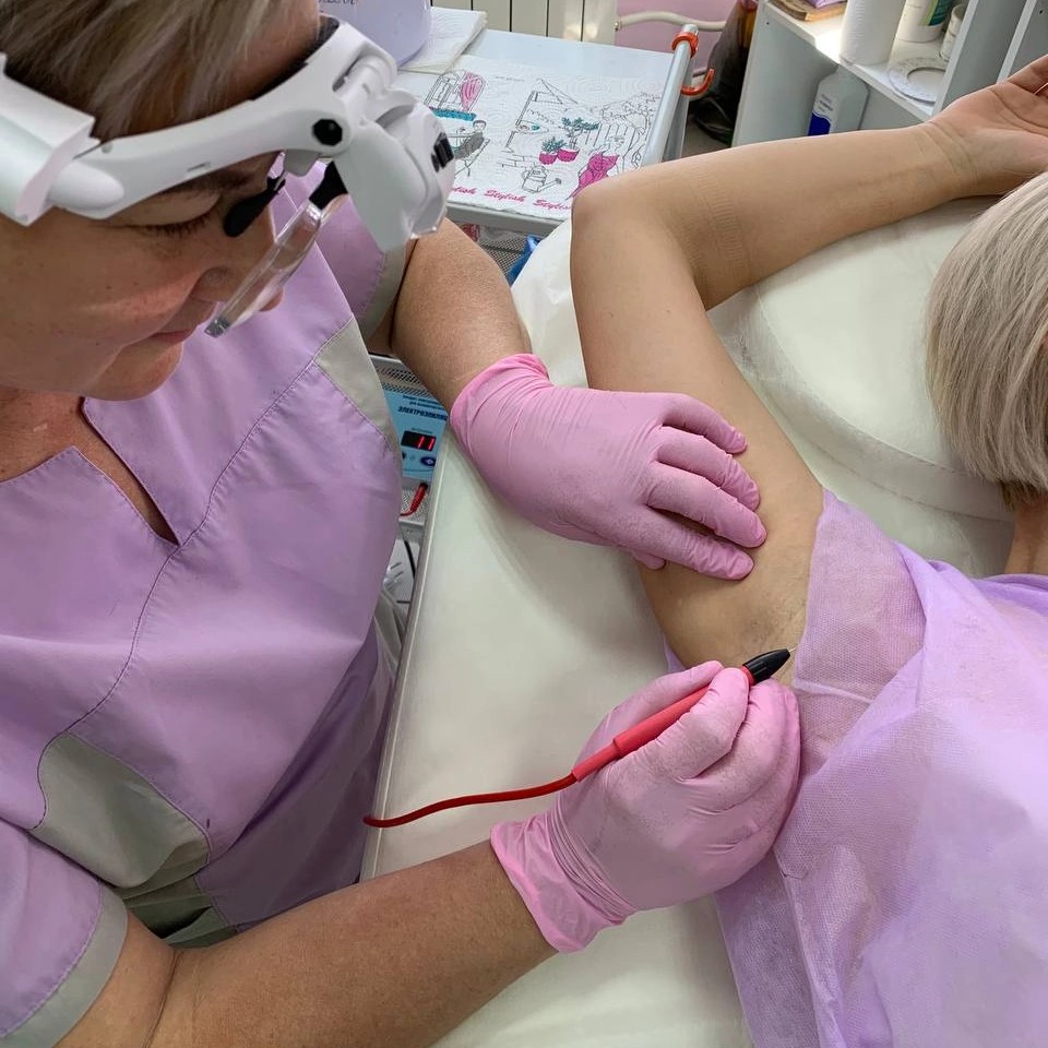 Электроэпиляция зоны бикини