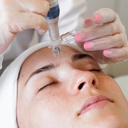 Microneedling Facial