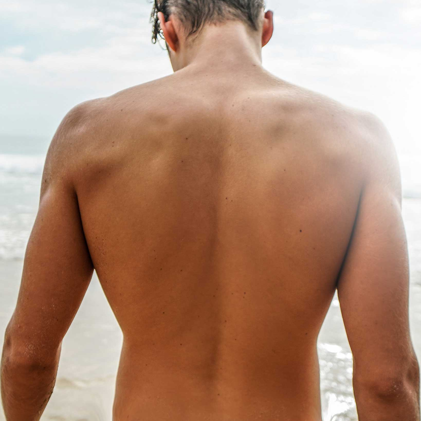 Back Laser Hair Removal
