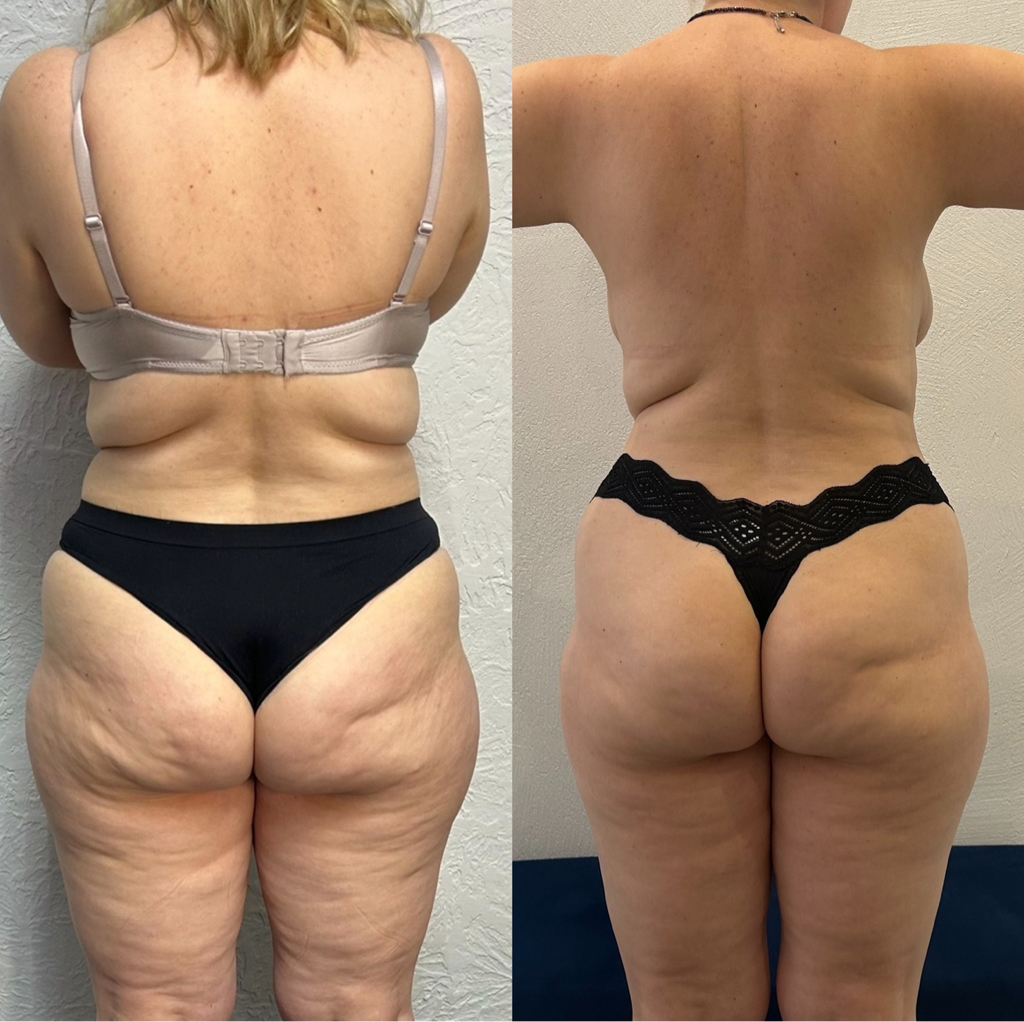 RSL pro( 10 посещений)