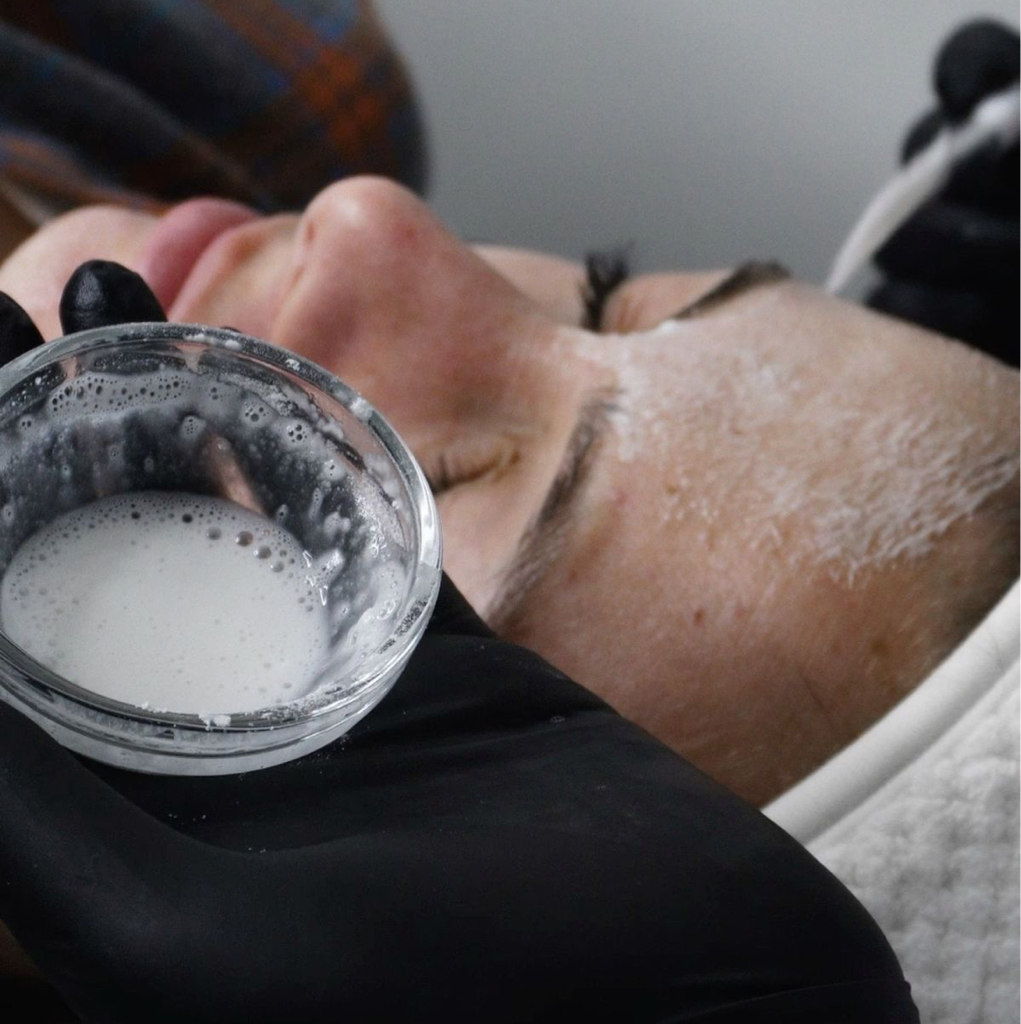 Карбокситерапия