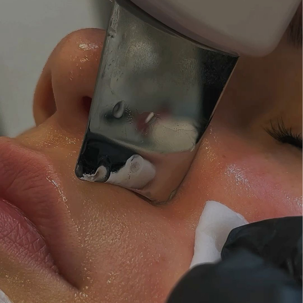 Комплексная чистка лица