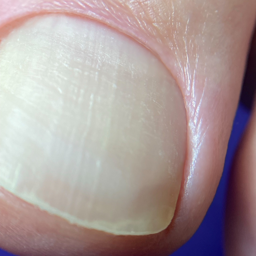 Обработка пальчиков