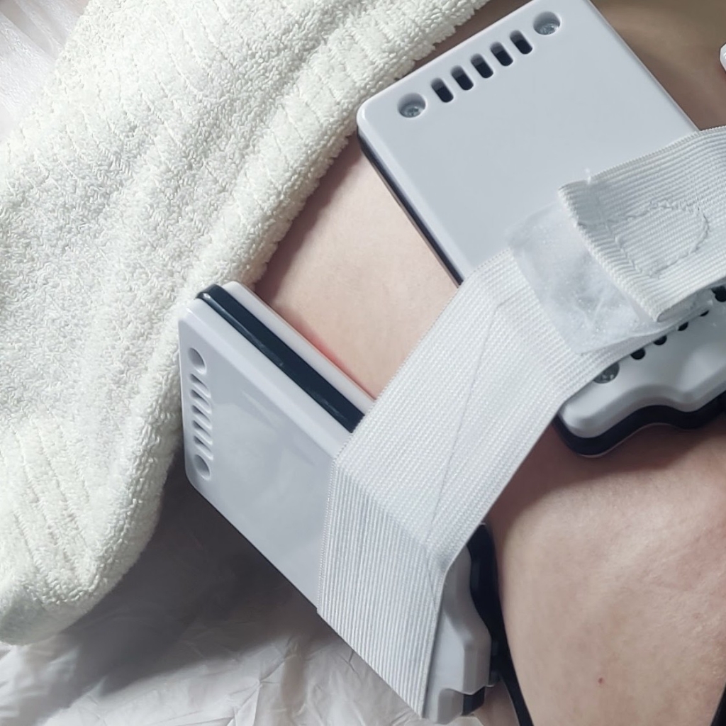 Липолазер 1 зона тела /лицо