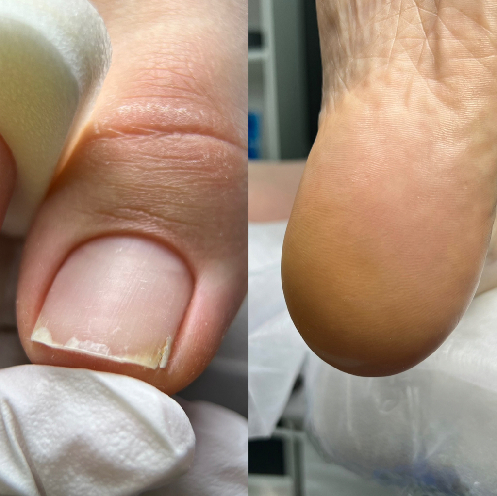 Педикюр полный: обработка стоп + пальчики ( без покрытия)