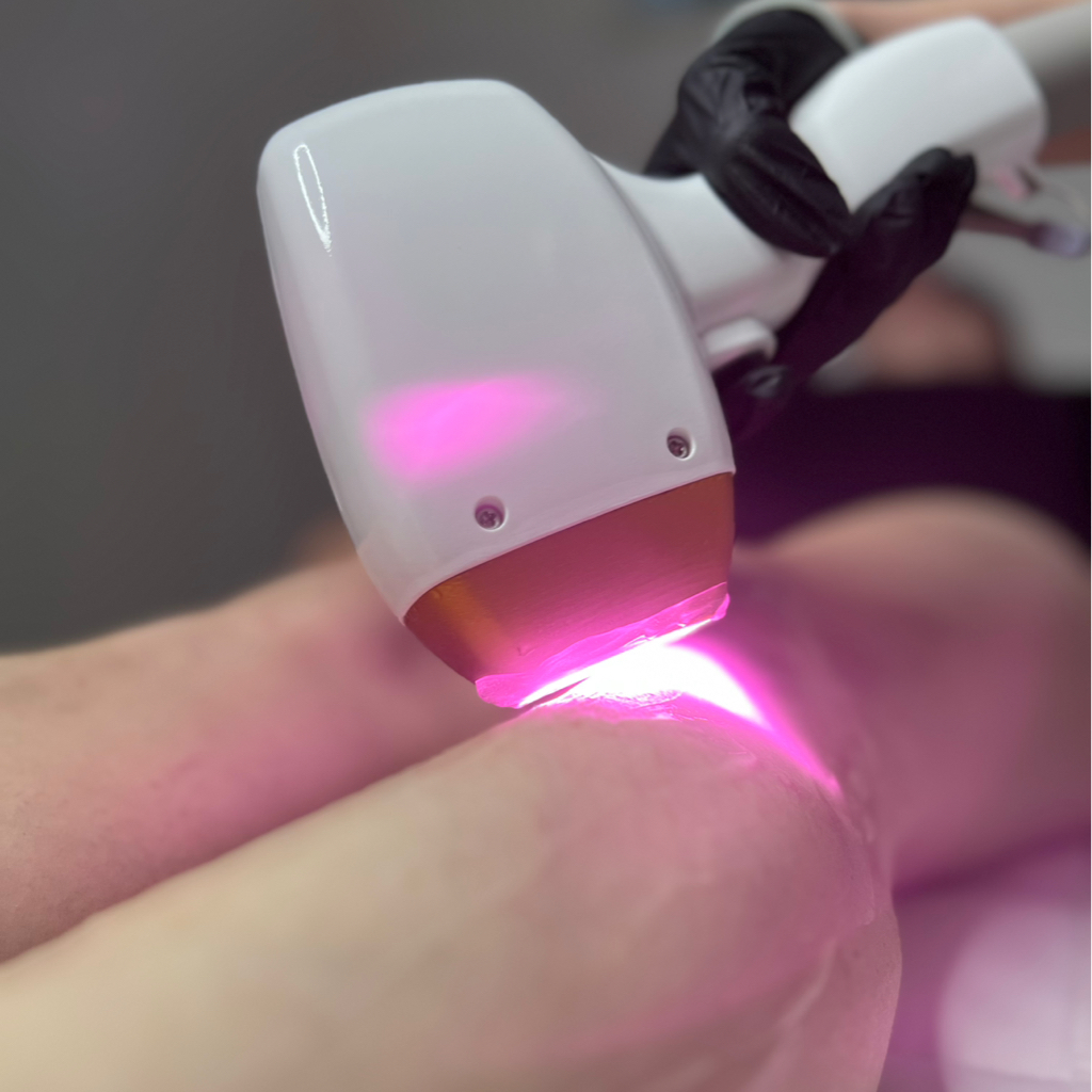 Лазерная эпиляция комплекс LIGHT (подмышечные впадины + гл. бикини)