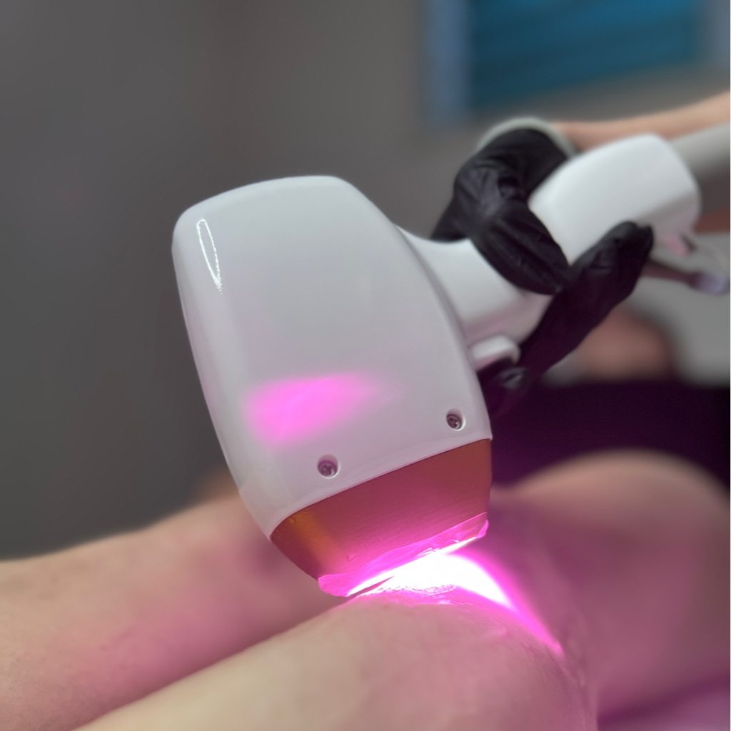 Лазерная эпиляция комплекс Beautiful  (любая зона на лице + подмышечные впадины)