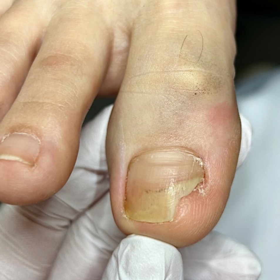 Консультация