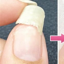 Ремонт ногтя