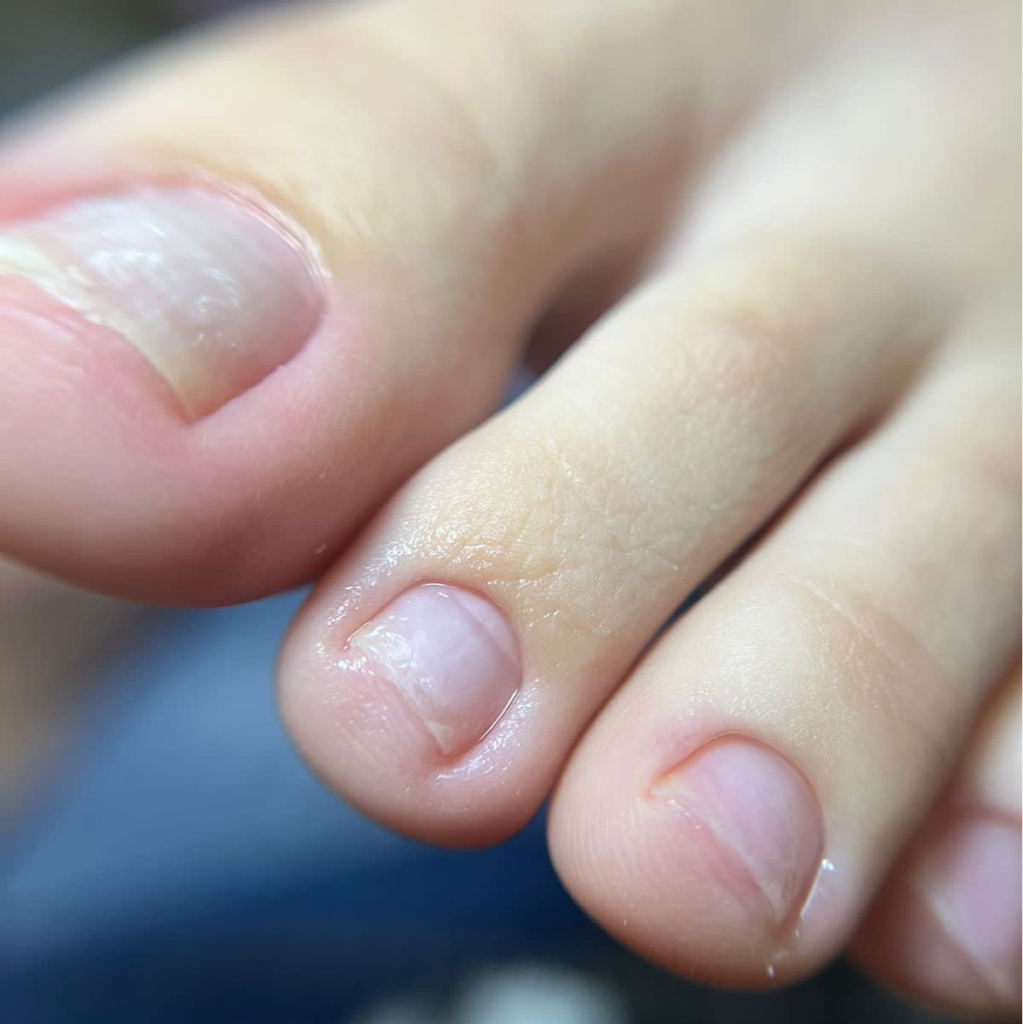 Обработка стопы+пальчики