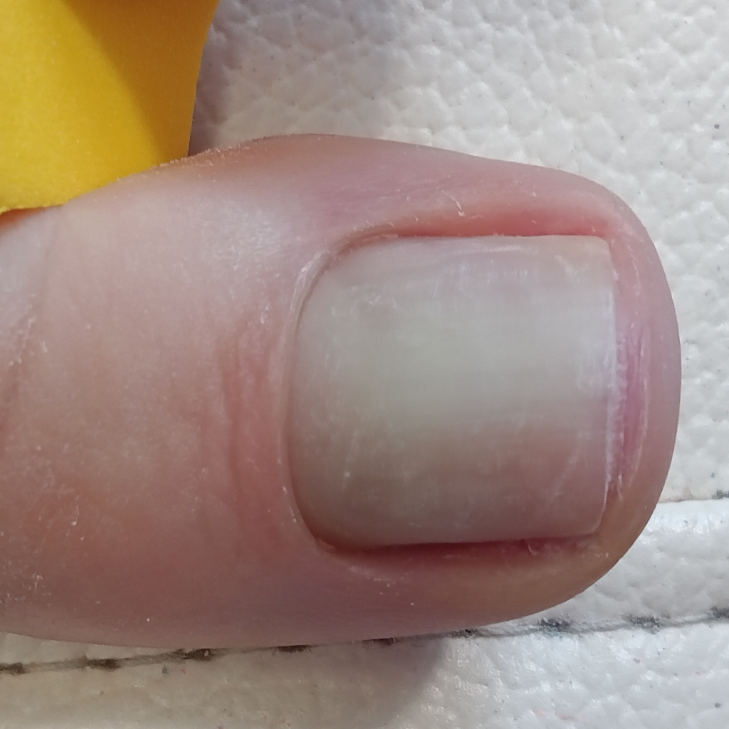 Парамедицинский Смарт педикюр