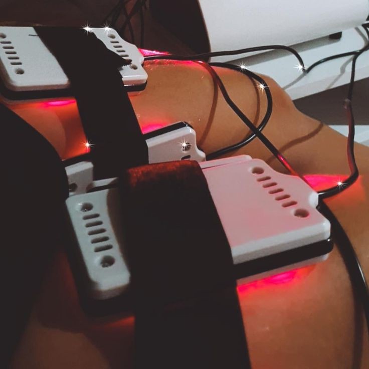 Лазерный липолиз