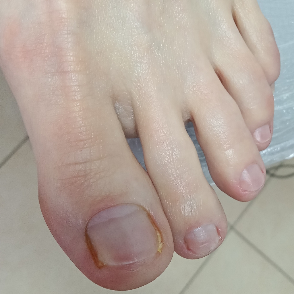 Аппаратный Смарт педикюр эстетика,без покрытия (сложная стопа)