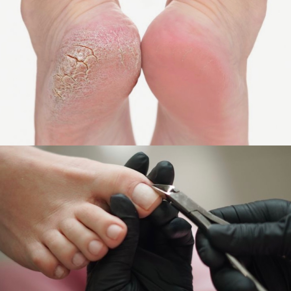 Обработка стопы +пальцы