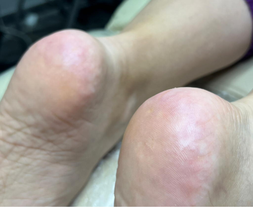 Педикюр стоп( ТОП МАСТЕР)