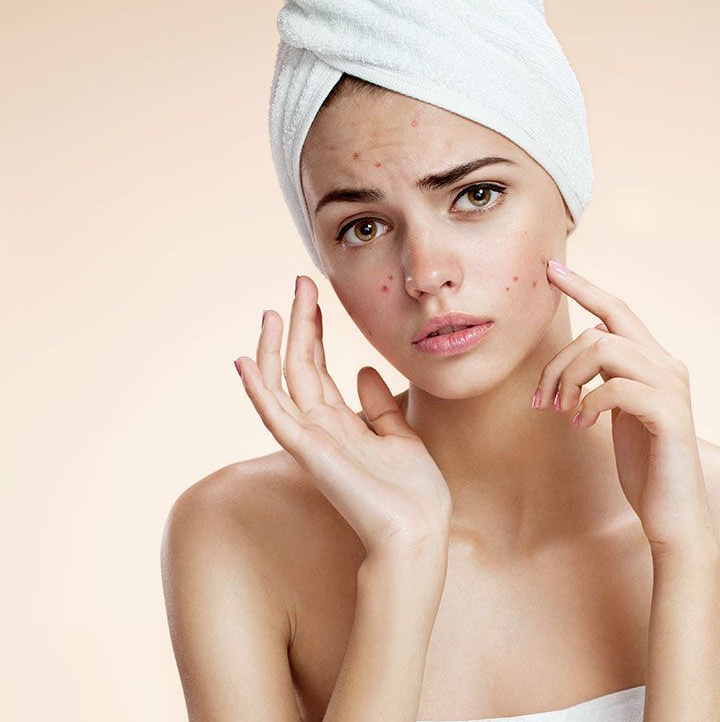 Чистка лица