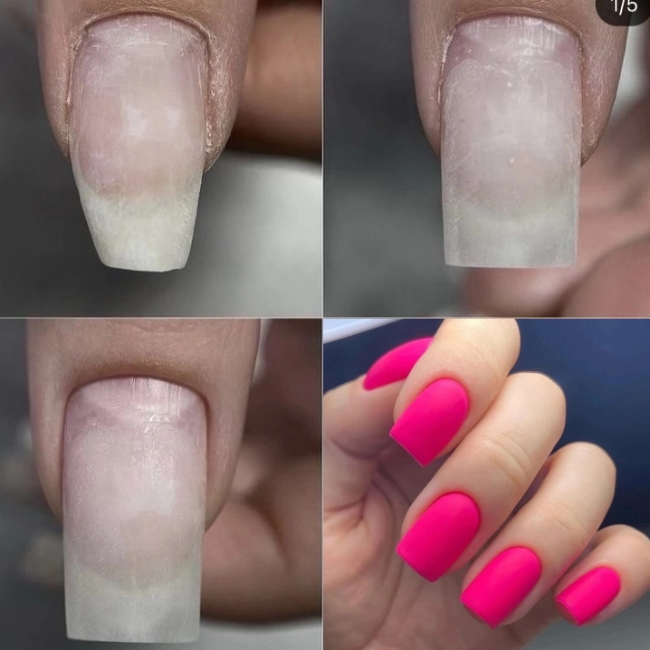 Ремонт/донаращивание