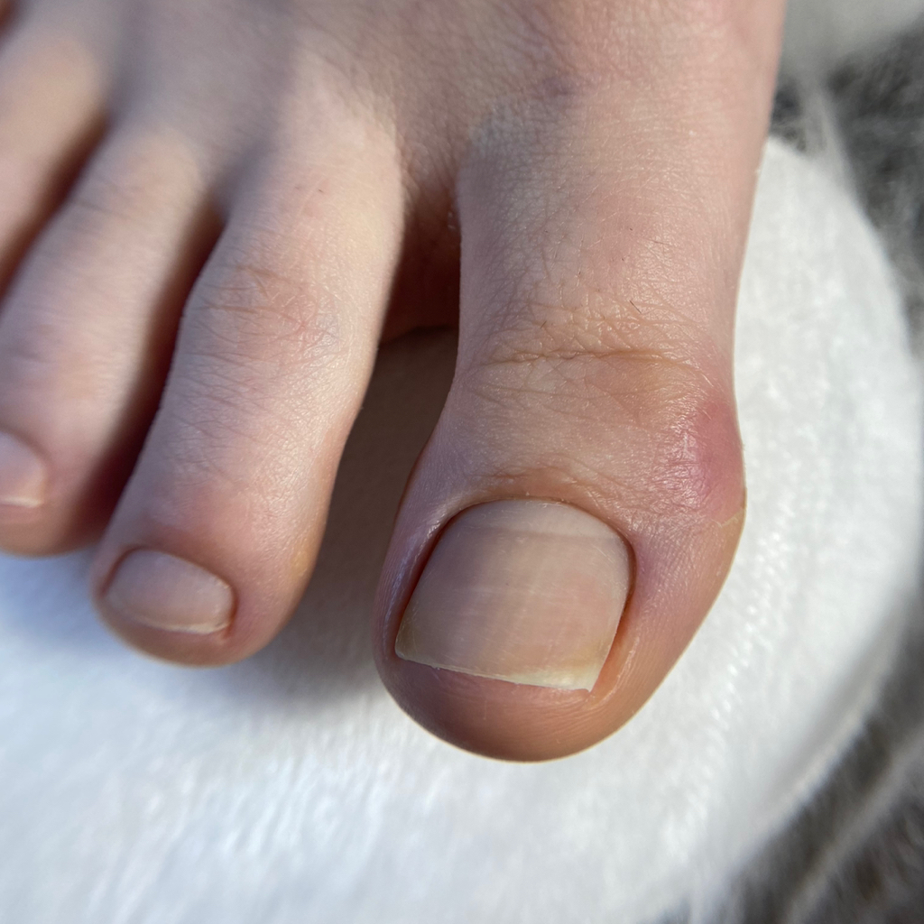 Педикюр пальчики