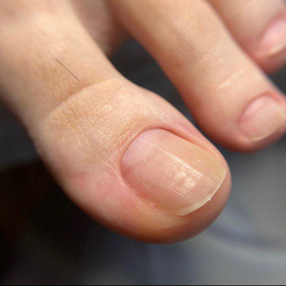 Гигиенический педикюр ( смарт)