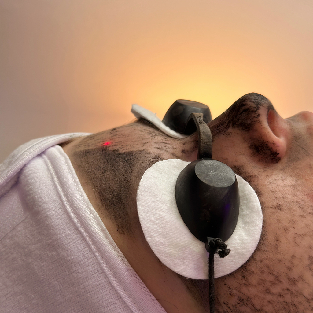 Карбоновый пилинг