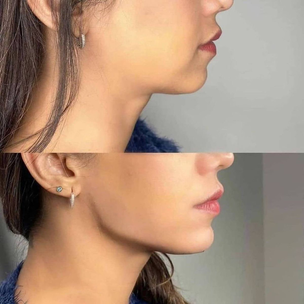 Профиль Джоли