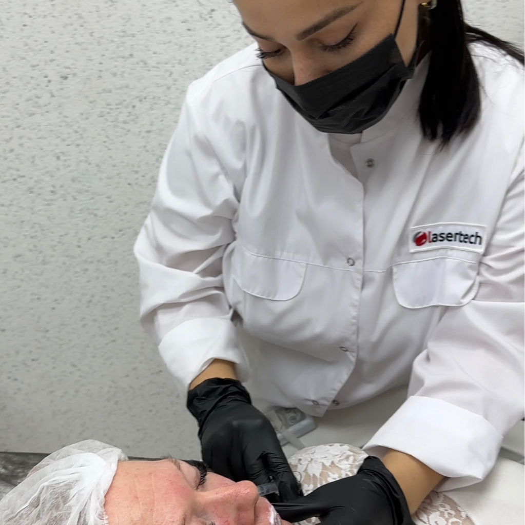 Заполнение носогубных складок