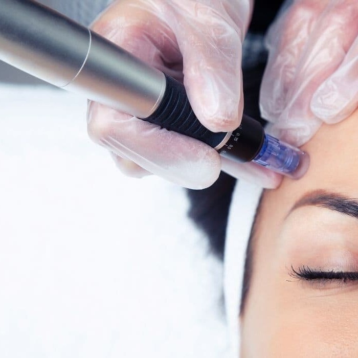 Клеточное омоложение лица + шея