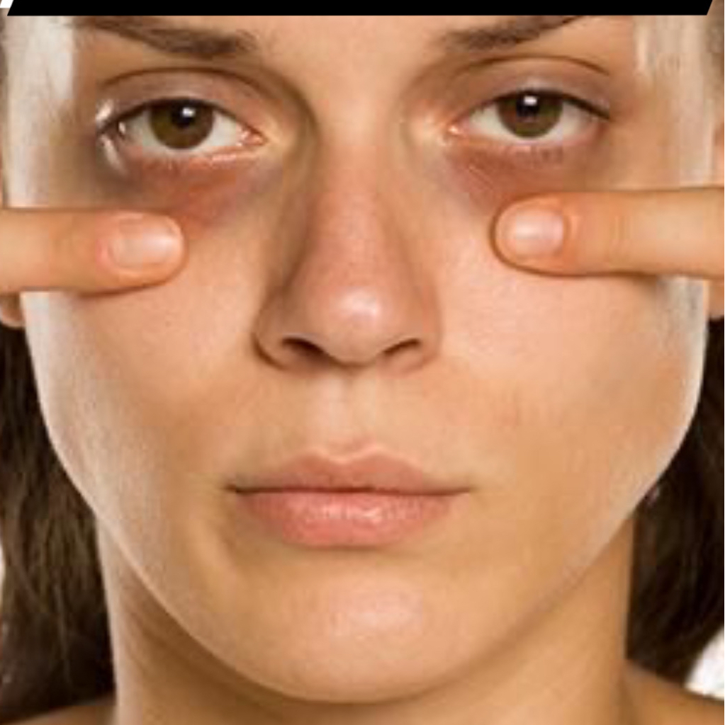 Биорепарация зоны вокруг глаз Brash open eyes