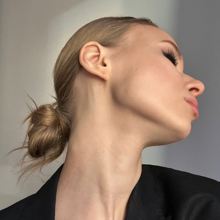 Контурная пластика скулы, углы челюсти, височная зона