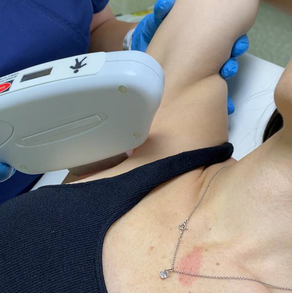 Подмышечные впадины