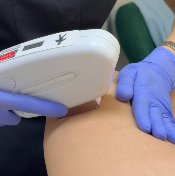 Комплекс 3: подмышки, глубокое бикини, голень без колена