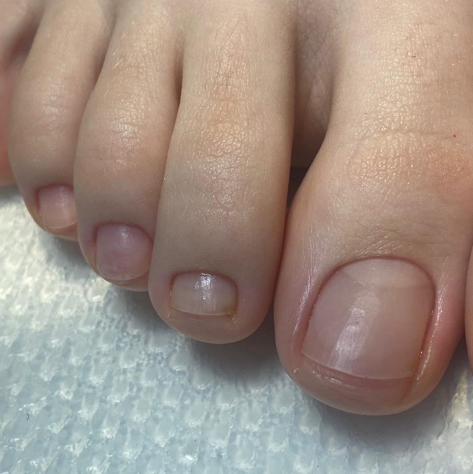 Педикюр гигиенический с обработкой стоп Smart дисками