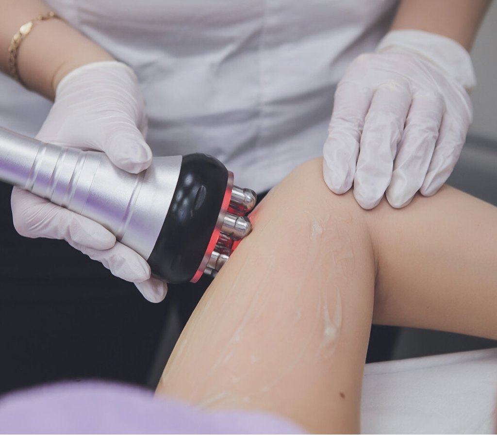 RF-лифтинг руки