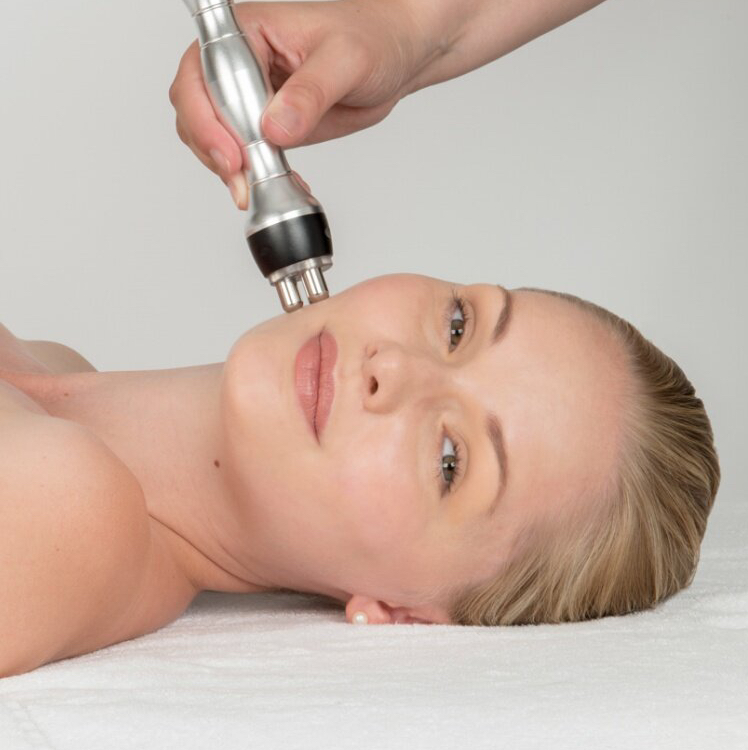 RF-лифтинг лица